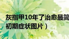 灰指甲10年了治愈最简单方法（5种灰指甲的初期症状图片）