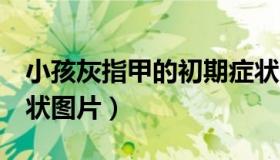 小孩灰指甲的初期症状（5种灰指甲的初期症状图片）