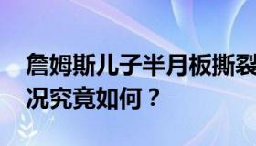 詹姆斯儿子半月板撕裂 具体是怎么回事？情况究竟如何？