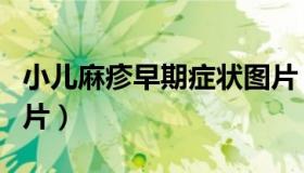 小儿麻疹早期症状图片（小儿麻疹的症状和图片）