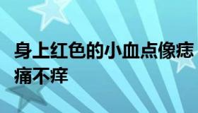 身上红色的小血点像痣（身上红色的小血点不痛不痒