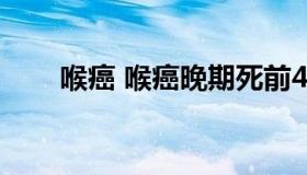 喉癌 喉癌晚期死前4个征兆要小心了