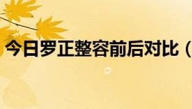 今日罗正整容前后对比（激光美白算整容吗）