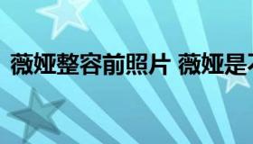 薇娅整容前照片 薇娅是不是整过容脸怪怪的