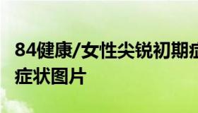 84健康/女性尖锐初期症状图片 女性尖锐初期症状图片