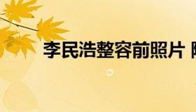 李民浩整容前照片 陈浩民整容对比