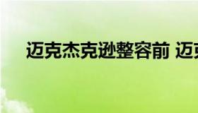 迈克杰克逊整容前 迈克尔杰克逊整容了