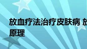 放血疗法治疗皮肤病 放血疗法治疗皮肤病的原理