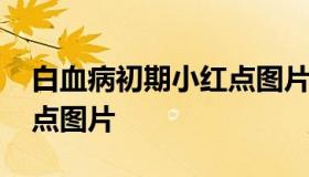 白血病初期小红点图片 婴儿白血病初期小红点图片