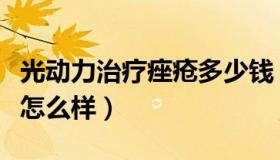 光动力治疗痤疮多少钱（光动力治疗痤疮效果怎么样）