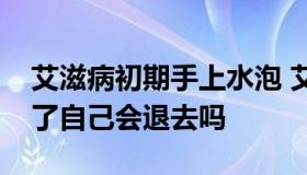 艾滋病初期手上水泡 艾滋病初期手上水泡长了自己会退去吗