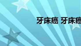 牙床癌 牙床癌会死人吗