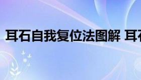 耳石自我复位法图解 耳石自我复位自己打滚