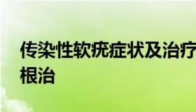 传染性软疣症状及治疗方法 传染性软疣如何根治