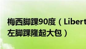 梅西脚踝90度（Liberty的天涯：梅西被拍到左脚踝隆起大包）