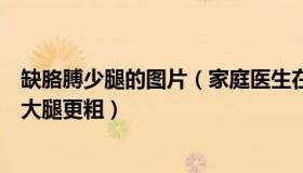 缺胳膊少腿的图片（家庭医生在线：研究发现缺觉的人胳膊大腿更粗）