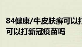 84健康/牛皮肤癣可以打新冠疫苗吗 牛皮肤癣可以打新冠疫苗吗