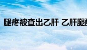 腿疼被查出乙肝 乙肝腿酸是不是病情严重了