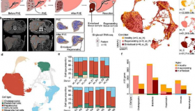  研究人员创建了再生肝脏的细胞图谱